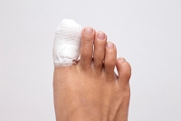 Diagnosing a Broken Toe