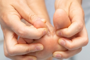 Athlete’s Foot Symptoms and Risk Factors
