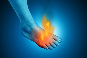 Erythromelalgia Causes Burning Pain in the Feet