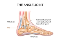 Ankle Joint Wear After Trauma