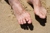 Preventing Hammertoe