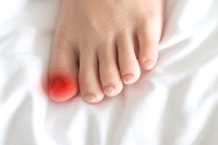 What Causes Ingrown Toenails?